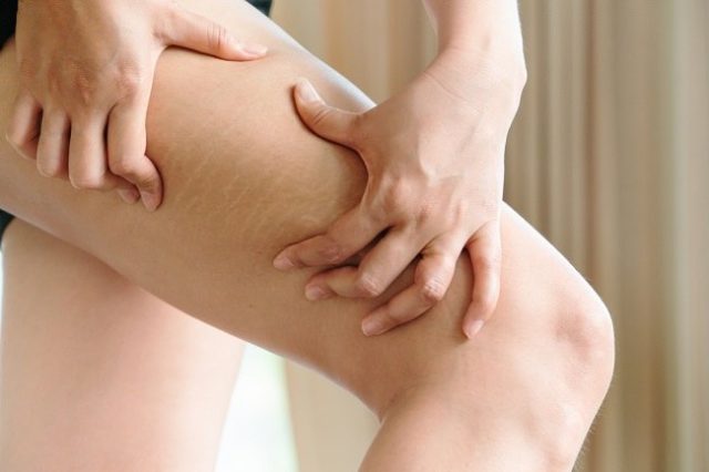 Kulit Putih & Tubuh Kurus: Tren Viral di Kalangan Remaja