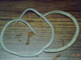 Tragedi Cacing Gelang Sukabumi