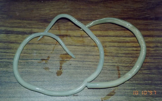 Tragedi Cacing Gelang Sukabumi