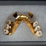 Inggris Catat Penemuan Spektakuler: 450.000 Artefak Sejarah Terkuak di Proyek Kereta Cepat HS2