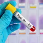 WHO Konfirmasi Kematian Wanita di Bangladesh Akibat Virus Nipah, Waspadai Konsumsi Getah Kurma Mentah