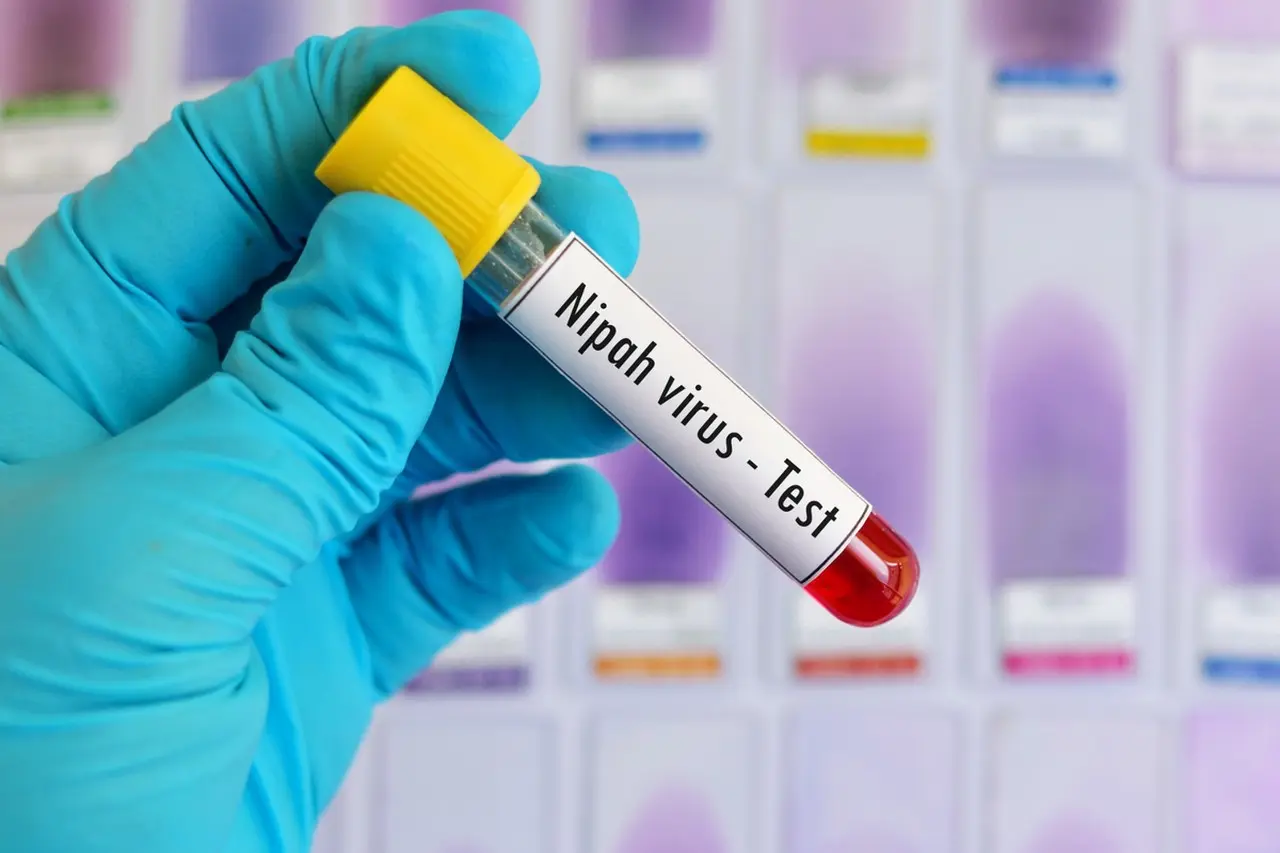 WHO Konfirmasi Kematian Wanita di Bangladesh Akibat Virus Nipah, Waspadai Konsumsi Getah Kurma Mentah